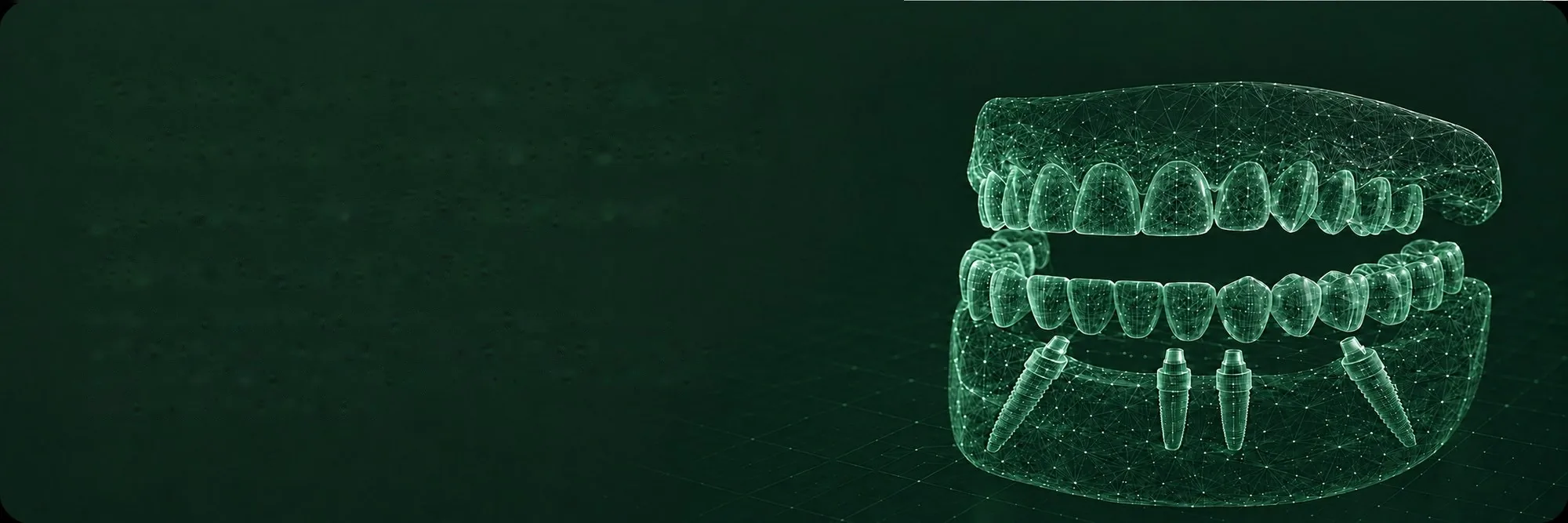 Straumann implantátumok digitális fogsor-modellen